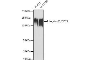 Western blot analysis of extracts of various cell lines, using Integrin-β1/CD29 antibody (ABIN6134032, ABIN6142578, ABIN6142579 and ABIN6219452) at 1:1000 dilution. (ITGB1 Antikörper  (AA 600-700))