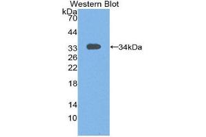 Western Blotting (WB) image for anti-Signal Transducing Adaptor Molecule (SH3 Domain and ITAM Motif) 1 (STAM) (AA 199-464) antibody (ABIN3206390) (STAM Antikörper  (AA 199-464))