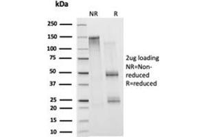 SDS-PAGE Analysis Purified Histone H1 Mouse Monoclonal Antibody (1415-1). (Histone H1 Antikörper)