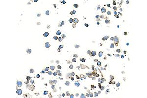 Immunocytochemistry (ICC) image for anti-CD28 (CD28) (AA 19-140) antibody (ABIN7448899) (Rekombinanter CD28 Antikörper  (AA 19-140))