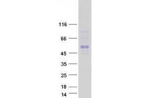 Validation with Western Blot (SBK1 Protein (Myc-DYKDDDDK Tag))