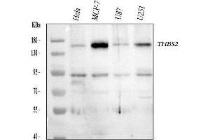 Western blot analysis of THBS2 using anti-THBS2 antibody (ABIN3042702).