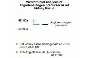 Western Blot analysis of antigiotensinogen precursor in rat kidney tissue. (AGT Antikörper  (AA 1-7))