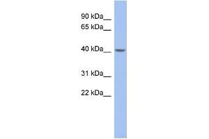 WB Suggested Anti-ZNF302 Antibody Titration:  0. (ZNF302 Antikörper  (Middle Region))