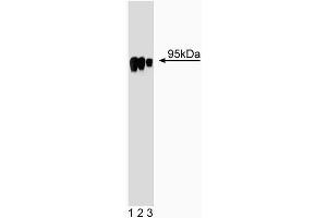 Western blot analysis of HIF-1beta on Jurkat cell lysate. (ARNT Antikörper  (AA 461-574))