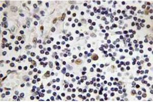 Immunohistochemistry analysis of TAL1 Antibody in paraffin-embedded human lymph node tissue. (TAL1 Antikörper)