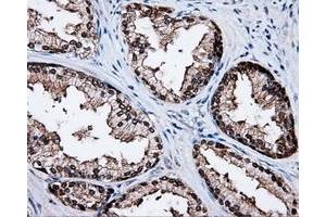 Immunohistochemistry (IHC) image for anti-Tubulin tyrosine Ligase-Like Family, Member 12 (TTLL12) antibody (ABIN1499035) (TTLL12 Antikörper)