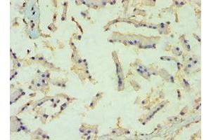 Immunohistochemistry of paraffin-embedded human prostate tissue using ABIN7152459 at dilution of 1:100 (TBL1XR1 Antikörper  (AA 1-180))