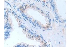 Immunohistochemistry (IHC) image for anti-serpin Peptidase Inhibitor, Clade B (Ovalbumin), Member 9 (SERPINB9) (AA 1-376) antibody (ABIN7435502)