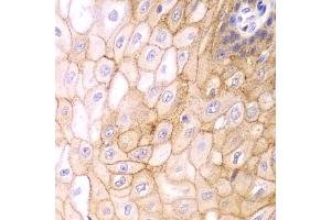 Immunohistochemistry of paraffin-embedded human esophagus using CLDN1 antibody (ABIN5971222) at dilution of 1/100 (40x lens). (Claudin 1 Antikörper)