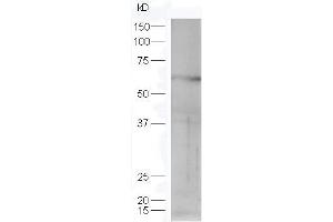 Lane 1: mouse lung probed with Rabbit Anti-STK40 Polyclonal Antibody, Unconjugated (ABIN872896) at 1:300 overnight at 4 °C.