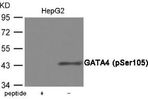 Western blot analysis of extracts from HepG2 cells using GATA4 (Phospho-Ser105) Antibody. (GATA4 Antikörper  (pSer105))