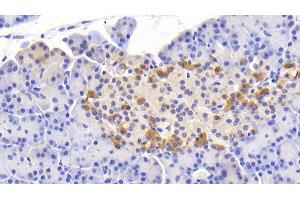 Detection of Slit2 in Human Pancreas Tissue using Polyclonal Antibody to Slit Homolog 2 (Slit2) (SLIT2 Antikörper  (AA 664-777))