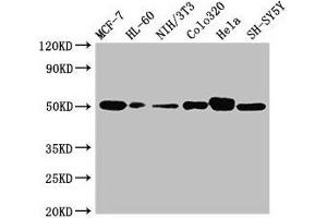 Western Blot Positive WB detected in: MCF-7 whole cell lysate, HL60 whole cell lysate, NIH/3T3 whole cell lysate, Colo320 whole cell lysate, Hela whole cell lysate, SH-SY5Y whole cell lysate All lanes: CALR antibody at 2 μg/mL Secondary Goat polyclonal to rabbit IgG at 1/10000 dilution Predicted band size: 49 kDa Observed band size: 49 kDa (Calreticulin Antikörper  (AA 18-417))