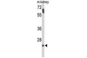 Western blot analysis of SMNDC1 Antibody (N-term) in mouse kidney tissue lysates (35µg/lane). (SMNDC1 Antikörper  (N-Term))