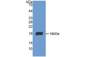 Detection of Recombinant COL3a1, Mouse using Polyclonal Antibody to Collagen Type III Alpha 1 (COL3a1) (COL3A1 Antikörper  (AA 1224-1371))