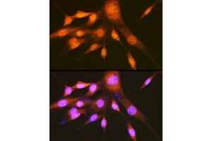 Immunofluorescence analysis of NIH-3T3 cells using hnRNP E2/PCBP2 Rabbit pAb (ABIN3023339, ABIN3023340, ABIN3023341 and ABIN6219620) at dilution of 1:100 (40x lens).