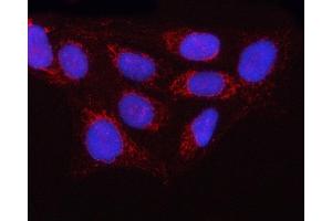 IF analysis of GTPBP9/OLA1 using anti-GTPBP9/OLA1 antibody (ABIN7602489).