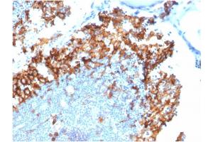 Immunohistochemistry (IHC) image for anti-Interleukin 3 Receptor, alpha (IL3RA) (AA 26-171) antibody (ABIN6939783)