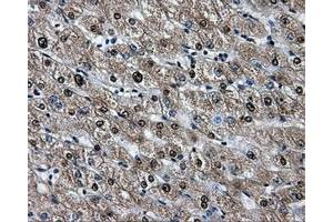 Immunohistochemical staining of paraffin-embedded liver tissue using anti-HSPA1Amouse monoclonal antibody. (HSP70 1A Antikörper)