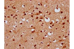 IHC image of ABIN7157277 diluted at 1:300 and staining in paraffin-embedded human brain tissue performed on a Leica BondTM system. (KLHL2 Antikörper  (AA 1-200))