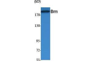 Western Blotting (WB) image for anti-SWI/SNF Related, Matrix Associated, Actin Dependent Regulator of Chromatin, Subfamily A, Member 2 (SMARCA2) (Internal Region) antibody (ABIN3178073) (SMARCA2 Antikörper  (Internal Region))