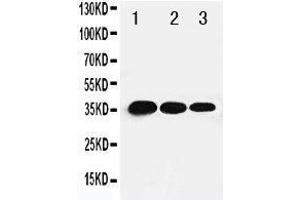 Lane 3: Recombinant Human TBX21 Protein 1. (T-Bet Antikörper  (C-Term))