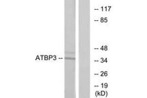 Western blot analysis of extracts from LOVO cells, using ATPBD3 Antibody. (ATPBD3 Antikörper  (AA 291-340))