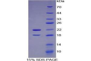 SDS-PAGE analysis of Mouse CSF2Ra Protein. (CSF2RA Protein)