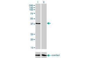 Western blot analysis of RNF14 over-expressed 293 cell line, cotransfected with RNF14 Validated Chimera RNAi (Lane 2) or non-transfected control (Lane 1).