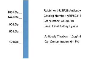 WB Suggested Anti-USP26  Antibody Titration: 0.