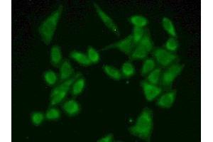 Detection of FUM in Human Hela Cell using Polyclonal Antibody to Fumarase (FUM) (FH Antikörper  (AA 45-188))