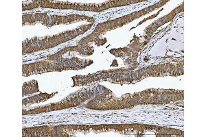 IHC analysis of CA1 using anti-CA1 antibody (ABIN3043766). (CA1 Antikörper  (AA 9-261))
