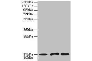 Western blot All lanes: UBE2D1 antibody at 2 μg/mL Lane 1: Mouse thymus tissue Lane 2: NIH/3T3 whole cell lysate Lane 3: Jurkat whole cell lysate Secondary Goat polyclonal to rabbit IgG at 1/10000 dilution Predicted band size: 17 kDa Observed band size: 17 kDa (UBE2D1 Antikörper  (AA 1-147))