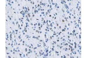 IHC analysis of MTA2 using anti-MTA2 antibody (ABIN7599519).