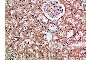 Immunohistochemical analysis of paraffin-embedded human-kidney, antibody was diluted at 1:200 (HMMR Antikörper  (AA 280-340))