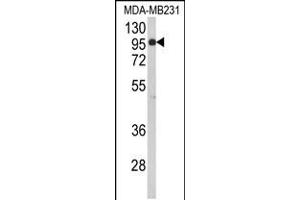Western blot analysis of BAHD1 Antibody in MDA-MB231 cell line lysates (35ug/lane) (BAHD1 Antikörper  (C-Term))