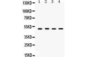 Western Blotting (WB) image for anti-Sulfotransferase Family, Cytosolic, 2B, Member 1 (SULT2B1) (AA 190-218), (Middle Region) antibody (ABIN3043414) (SULT2B1 Antikörper  (Middle Region))