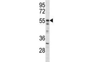 Akt2 antibody western blot analysis in mouse NIH3T3 lysate (AKT2 Antikörper  (AA 93-122))