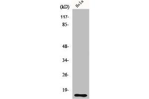 Western Blot analysis of HeLa cells using DOC-1 Polyclonal Antibody (CDK2AP1 Antikörper  (Internal Region))