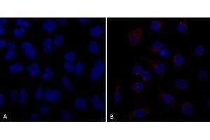 Immunocytochemistry/Immunofluorescence analysis using Mouse Anti-VPS35 Monoclonal Antibody, Clone 10A8 (ABIN6933002). (VPS35 Antikörper  (PE))