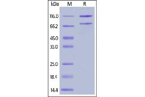 Rat Complement C5, His Tag on  under reducing (R) condition. (C5 Protein (AA 24-1688) (His tag))