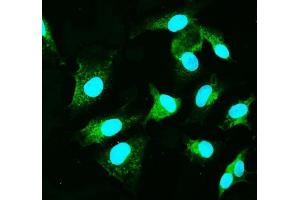 IF analysis of CARD9 using anti-CARD9 antibody (ABIN7599386).