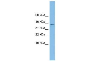 KLHDC9 antibody used at 1 ug/ml to detect target protein.
