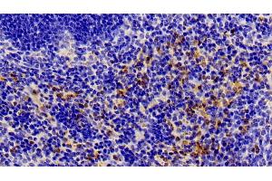 Immunohistochemistry (IHC) image for anti-Annexin A1 (ANXA1) (AA 6-346) antibody (ABIN7435880)