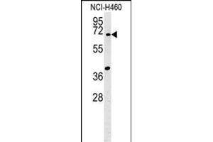 SYN3 Antibody (Center) (ABIN651941 and ABIN2840467) western blot analysis in NCI- cell line lysates (15 μg/lane). (Synapsin III Antikörper  (AA 363-388))