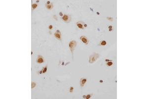 Immunohistochemistry (Paraffin-embedded Sections) (IHC (p)) image for anti-Methyl CpG Binding Protein 2 (MECP2) (AA 400-428) antibody (ABIN389123)