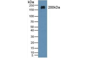 Detection of MAP2 in Rat Brain Tissue using Polyclonal Antibody to Microtubule Associated Protein 2 (MAP2) (MAP2 Antikörper  (AA 727-985))