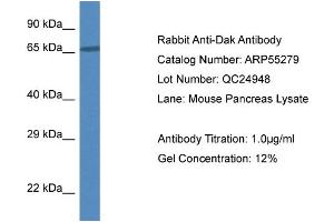 Western Blotting (WB) image for anti-Dihydroxyacetone Kinase 2 Homolog (DAK) (N-Term) antibody (ABIN2786123) (DAK Antikörper  (N-Term))