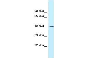 WB Suggested Anti-Gcat Antibody   Titration: 1. (GCAT Antikörper  (C-Term))
